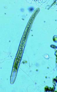 Spirostomum intermedium